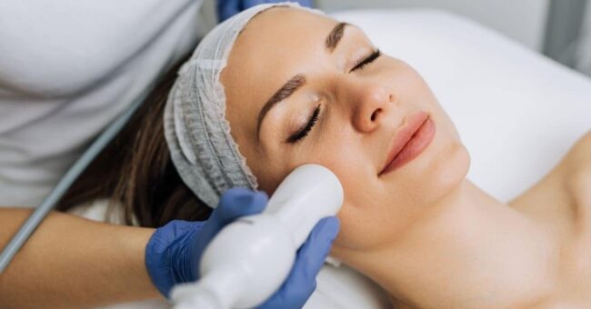 microneedling – contour woman getting microneedling procedure